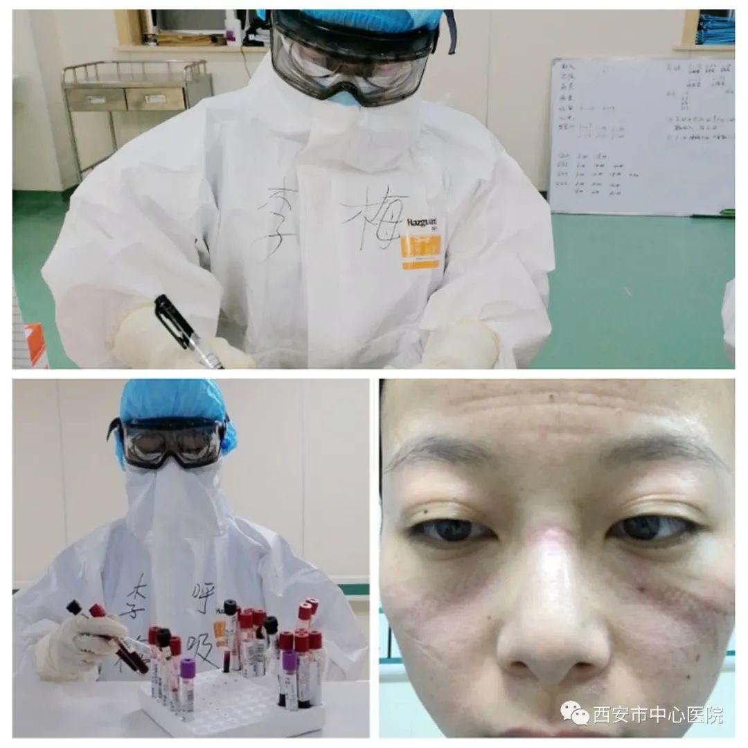 疫情中的守护者，一位普通护士的非凡事迹